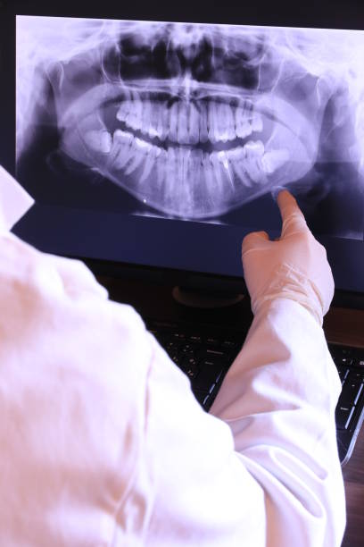 Best Emergency Wisdom Teeth Removal in Carteret, NJ