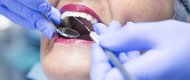 Best Emergency Treatment for Dental Infections or Abscesses in Carteret, NJ